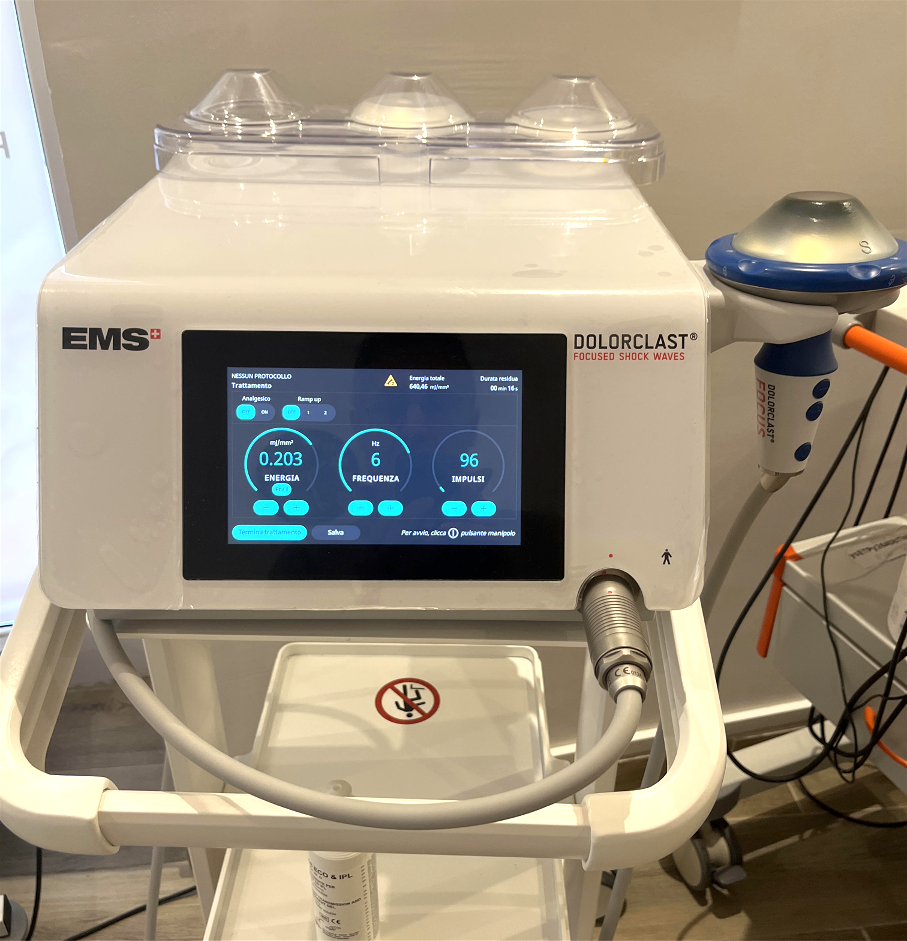 Onde d'Urto Radiali e Focali a Novi Ligure — Studio Nuova Fisioterapia